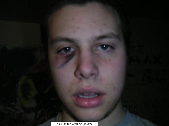 !@%#$  :finger: poze v5